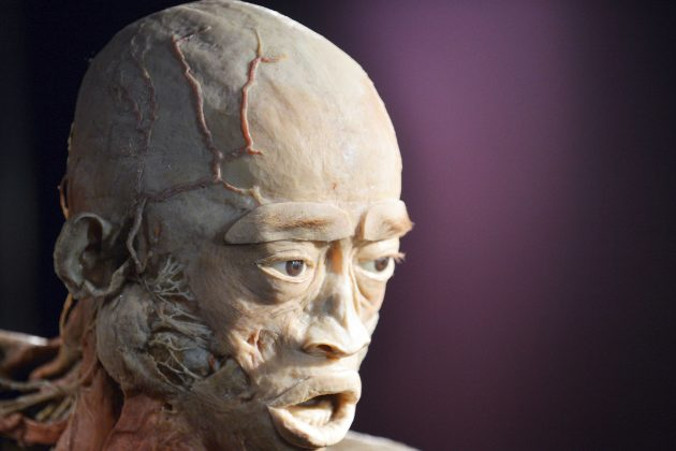 Plastynacja użyta w celu przygotowania ciał do wystawy „Real Bodies” jest procesem, w którym wykorzystuje się ciekłą gumę silikonową w celu zapobiegnięcia naturalnemu procesowi gnilnemu tkanek. Powyższe zdjęcie zwłok pochodzi z wcześniejszej wystawy zatytułowanej „The Human Body” w Kijowie (Sergei Supinsky/AFP/Getty Images)