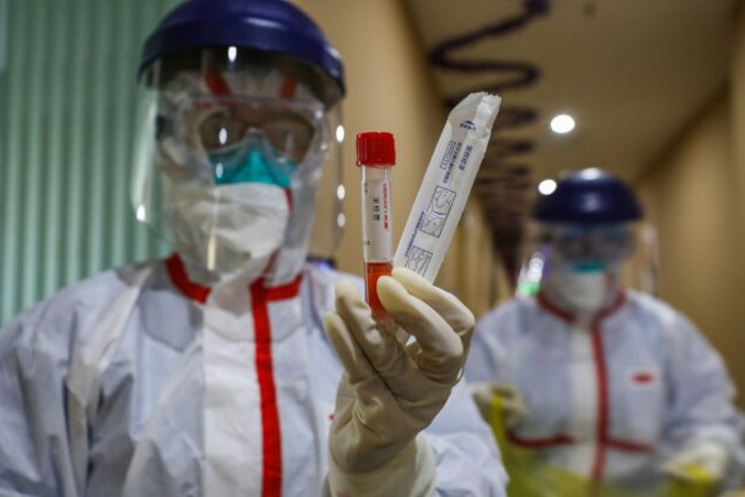 Członek personelu medycznego pokazuje probówkę po pobraniu próbek od osoby, która ma zostać zbadana pod kątem nowego koronawirusa, strefa kwarantanny w mieście Wuhan, prowincja Hubei, 4.02.2020 r.<br/>(STR/AFP via Getty Images)