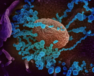 Niedatowane zdjęcie udostępnione przez Narodowe Instytuty Zdrowia, ang. National Institutes of Health, NIH, pokazuje obraz ze skaningowego mikroskopu elektronowego przedstawiający wirusa SARS-CoV-2 (okrągłe niebieskie obiekty), wyłaniającego się z powierzchni komórek hodowanych w laboratorium, wydane 27.02.2020 r. SARS-CoV-2, znany również jako 2019-nCoV, jest wirusem wywołującym chorobę COVID-19. Pokazany wirus został wyizolowany od pacjenta w USA<br/>(NIAID- RML/NATIONAL INSTITUTES OF HEALTH HANDOUT/PAP/EPA)