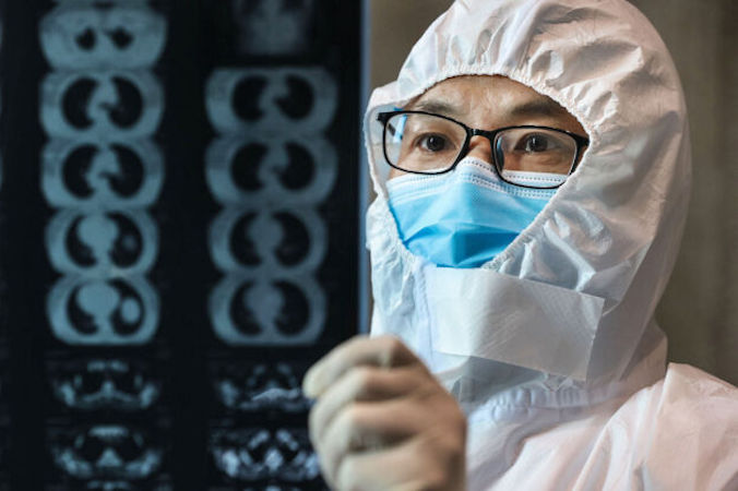 Lekarz ogląda zdjęcie tomografii płuc w szpitalu w Yunmeng, prefektura Xiaogan, prowincja Hubei w centralnych Chinach, 20.02.2020 r. (STR/AFP via Getty Images)