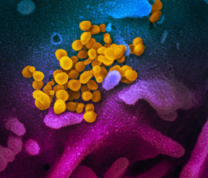Ten obraz z elektronowego mikroskopu skaningowego pokazuje wirusa KPCh (okrągłe żółte kropki), wyłaniającego się z powierzchni komórek wyhodowanych w laboratorium. Pokazany wirus został wyizolowany od pacjenta z USA. Zdjęcie opublikowane 19.02.2020 r. (fot. <a href="https://www.niaid.nih.gov/news-events/new-coronavirus-stable-hours-surfaces">NIAID-RML</a>, <a href="https://creativecommons.org/licenses/by/2.0/">CC BY 2.0</a>)