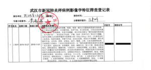 Zrzut ekranu ujawnionego dokumentu, który zawiera informacje nt. pacjenta z objawami podobnymi do COVID-19 ze szpitala Wuhan nr 6, 21.02.2020 r. Część informacji została zredagowana przez „The Epoch Times” w celu ochrony prywatności pacjentów (dostarczone do „The Epoch Times”)