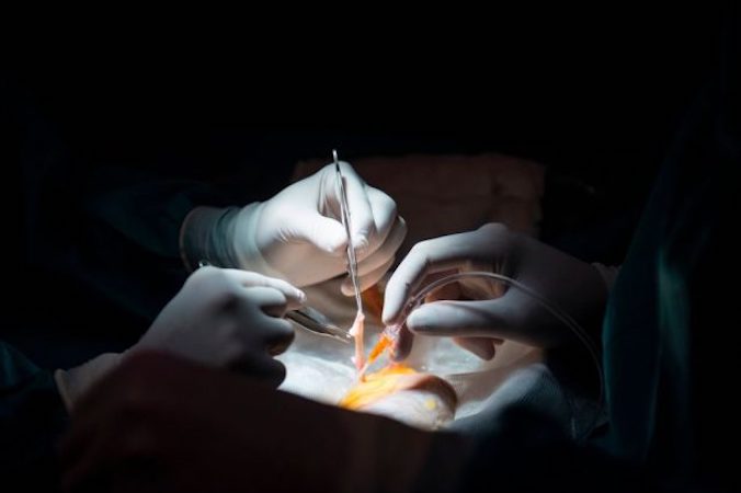 Lekarze przygotowują się do przeszczepu nerki, zdjęcie z akt (Pierre-Philippe Marcou/AFP/Getty Images)