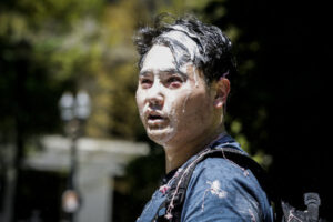 Andy Ngo, dziennikarz z Portland jest pokryty niezidentyfikowaną substancją w wyniku ataku na niego, dokonanego przez Antifę w Portland w stanie Oregon, 29.06.2019 r. (Moriah Ratner / Getty Images)
