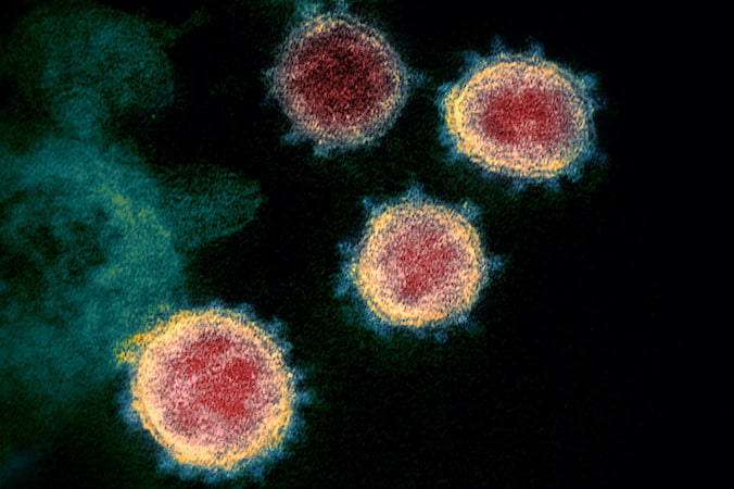 Ten kolorowy obraz z transmisyjnego mikroskopu elektronowego przedstawia SARS-CoV-2 – znany również jako 2019-nCoV, wirus wywołujący COVID-19 – wyizolowany od pacjenta w USA. Od kolców na zewnętrznej krawędzi cząstek wirusa, przypominającej koronę, nadano koronawirusom ich nazwę (<a href="https://www.flickr.com/photos/niaid/49534865371/">NIAID</a>, <a href="https://creativecommons.org/licenses/by/2.0">CC BY 2.0</a> / <a href="https://commons.wikimedia.org/w/index.php?curid=92612457">Wikimedia</a>)